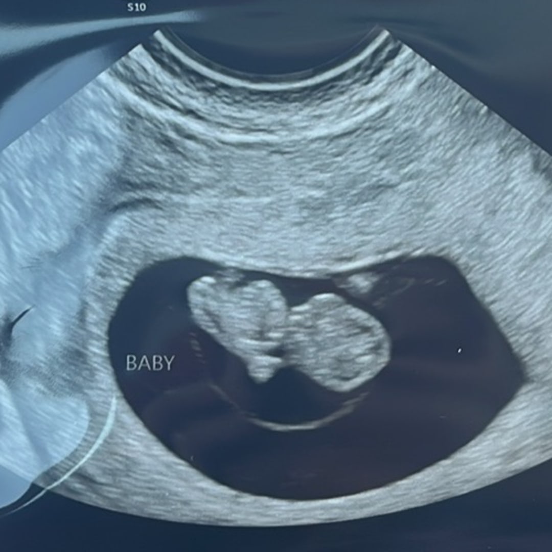 Photo shared by Alicia for their Babylist baby registry.