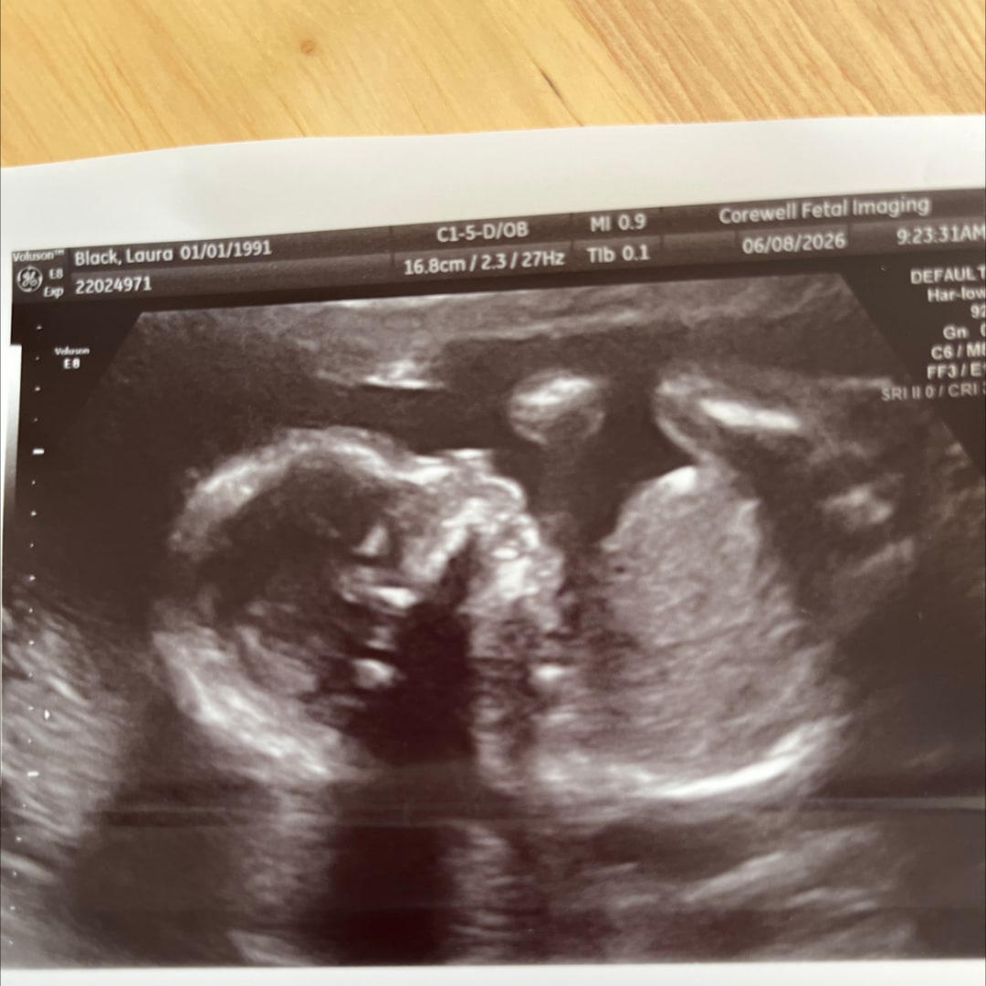 Photo shared by Laura for their Babylist baby registry.