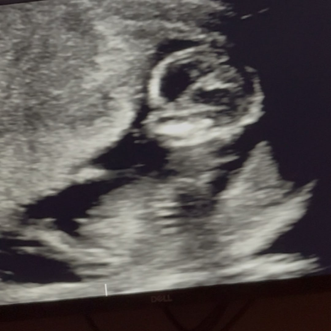 Photo shared by Brianna for their Babylist baby registry.