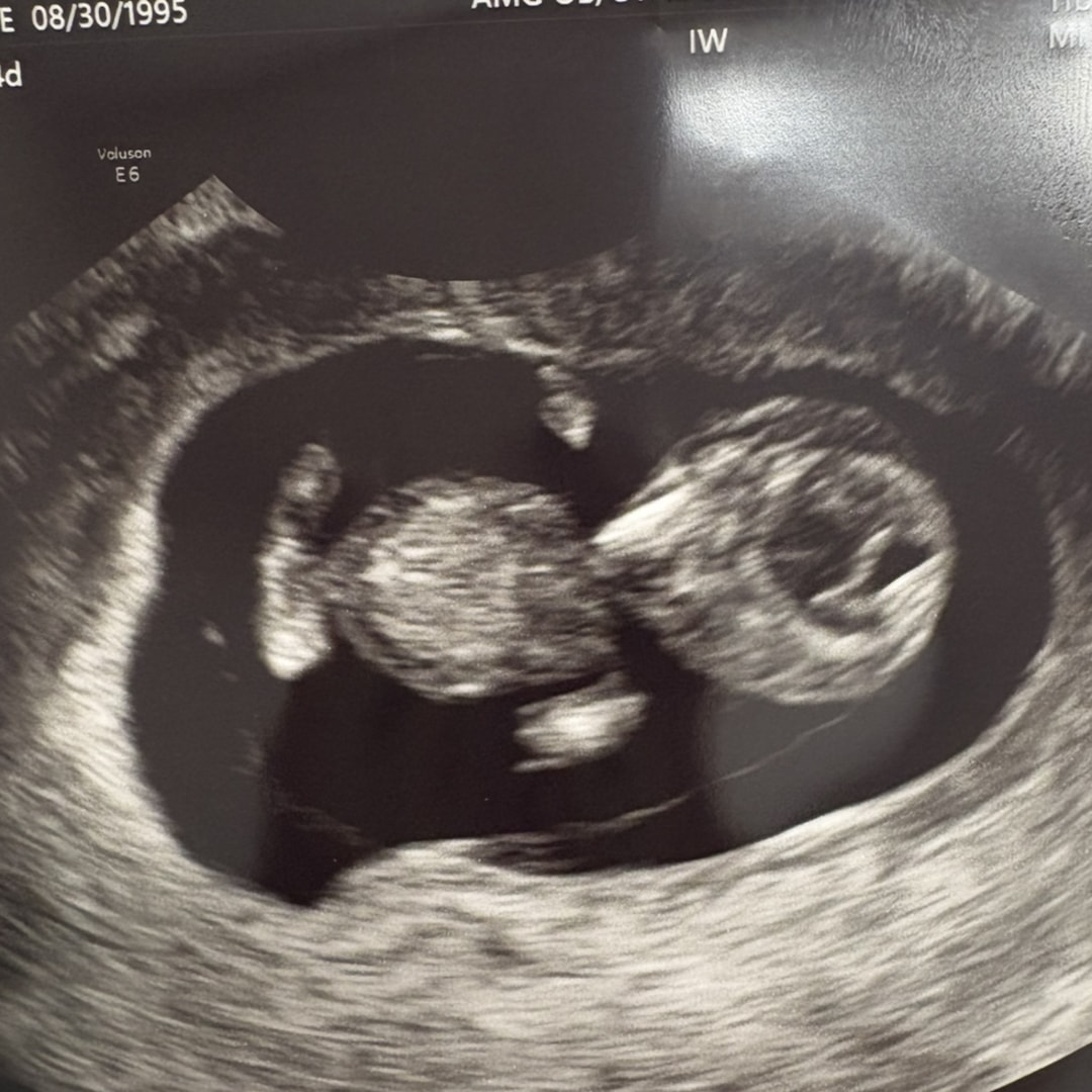 Photo shared by Stephanie for their Babylist baby registry.