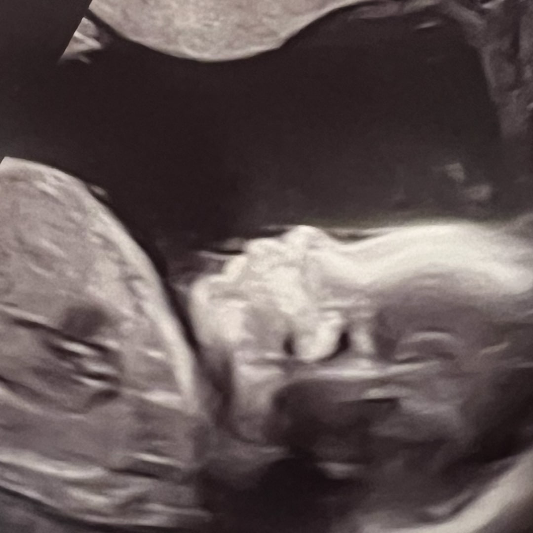 Photo shared by Gallory for their Babylist baby registry.