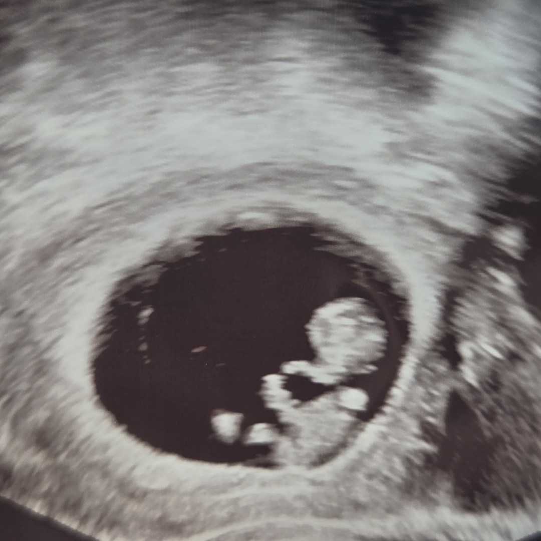 Photo shared by Myah for their Babylist baby registry.