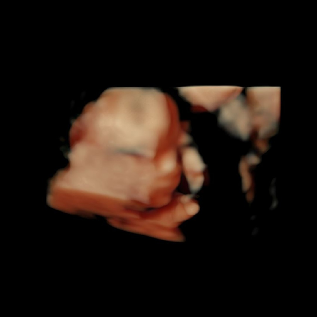 Photo shared by Haley for their Babylist baby registry.