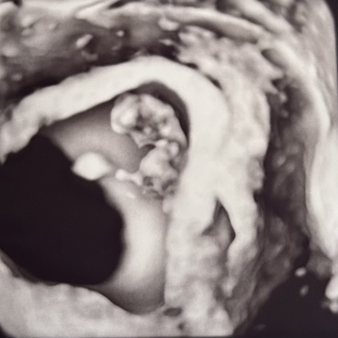 Photo shared by Ashley for their Babylist baby registry.