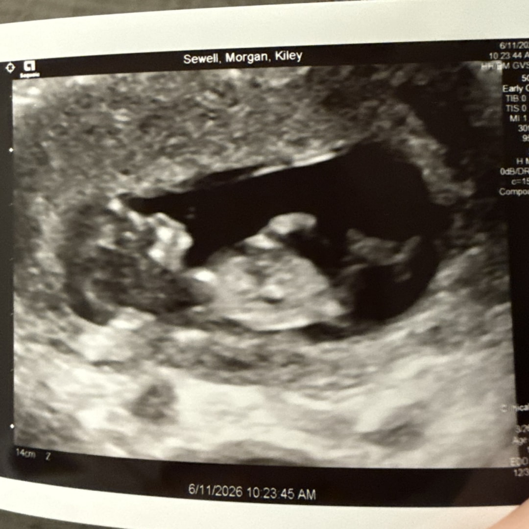 Photo shared by Morgan for their Babylist baby registry.