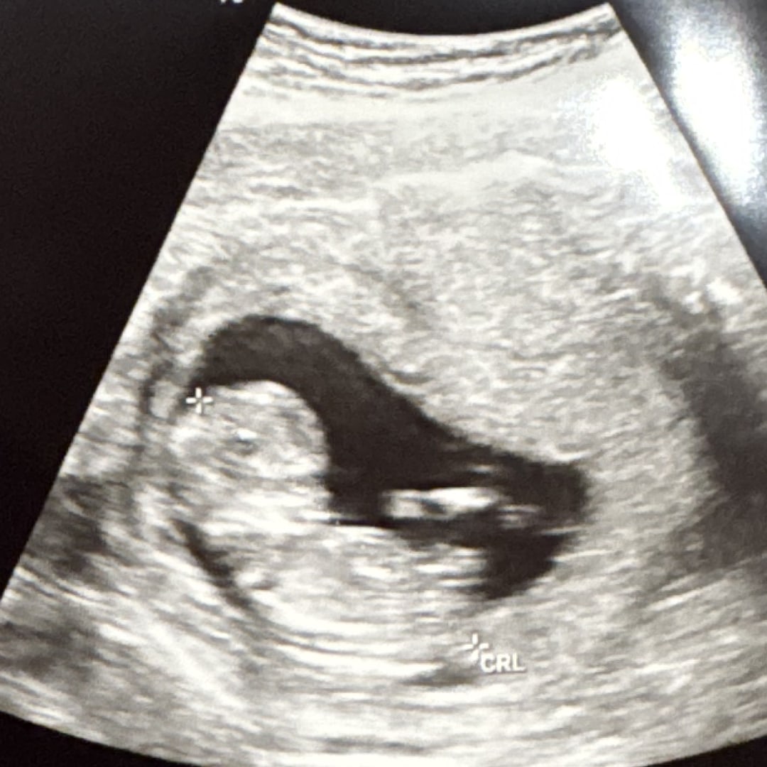 Photo shared by Alexis for their Babylist baby registry.