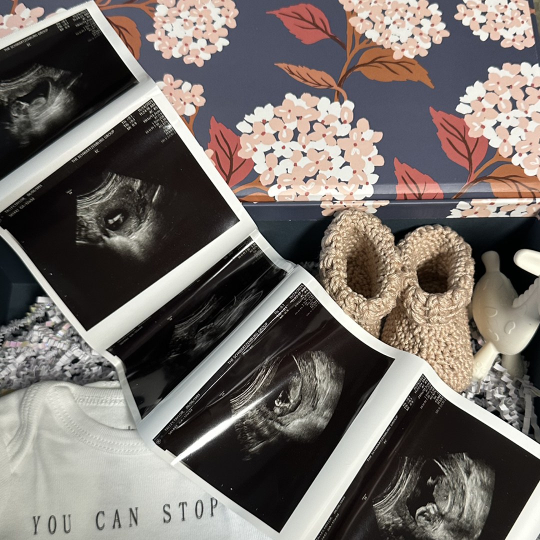 Photo shared by Taylor for their Babylist baby registry.