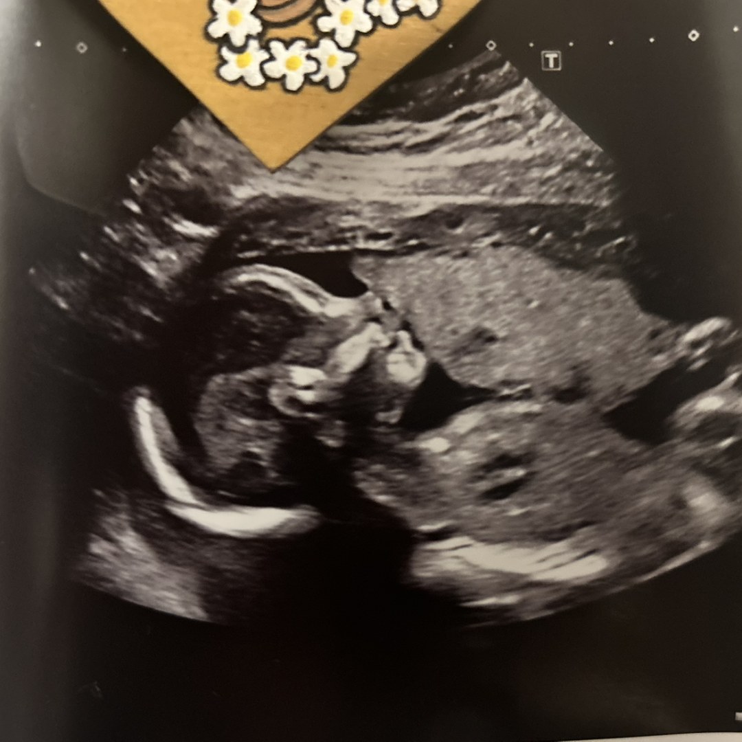 Photo shared by Cheyenne for their Babylist baby registry.