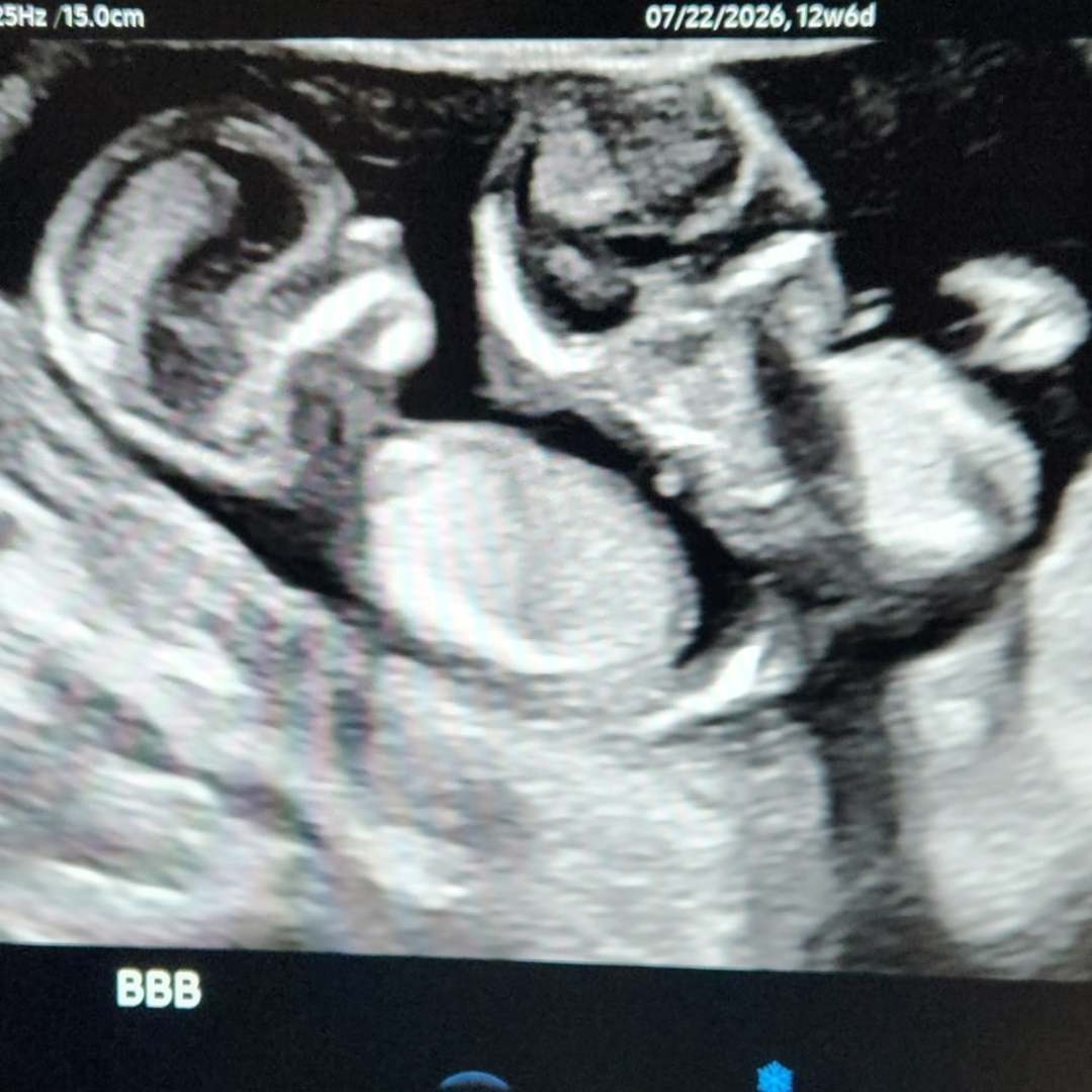 Photo shared by Bri for their Babylist baby registry.