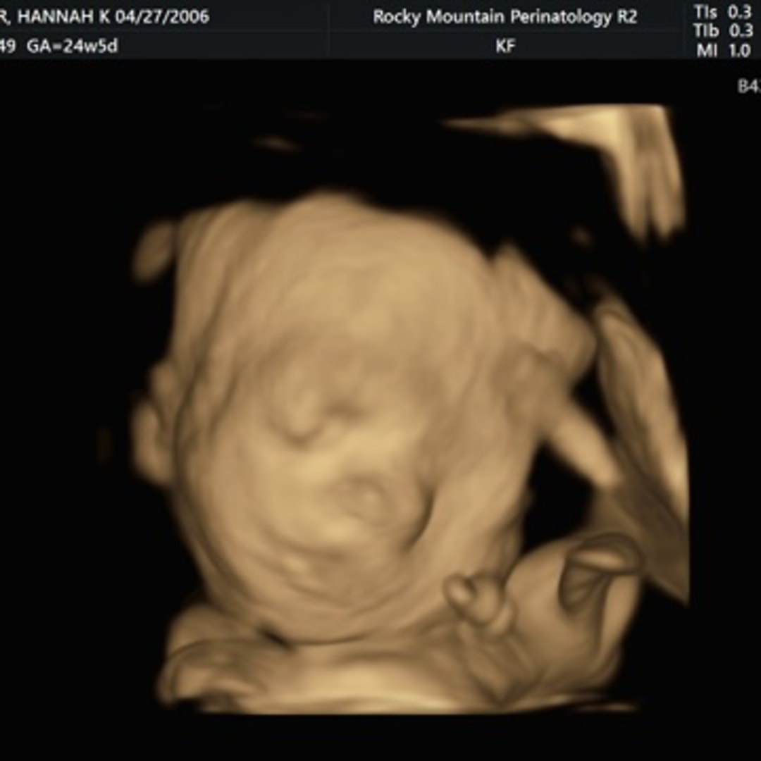 Photo shared by Aksil for their Babylist baby registry.