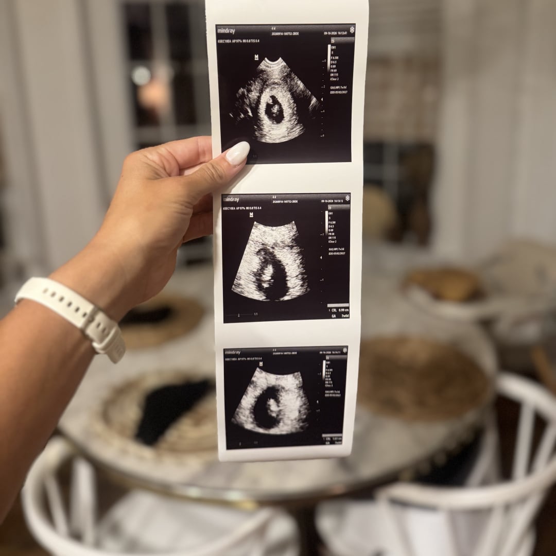 Photo shared by Kate for their Babylist baby registry.