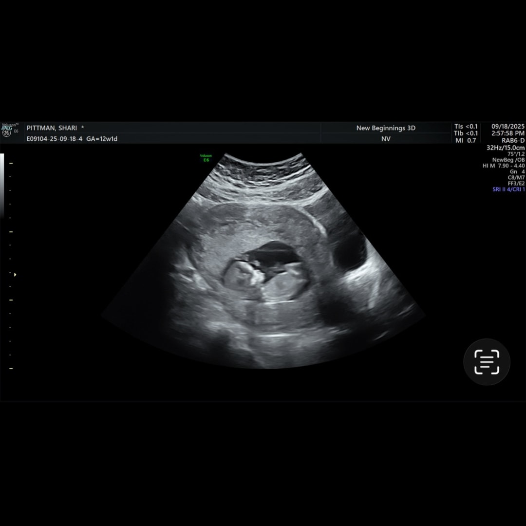 Photo shared by Shari for their Babylist baby registry.