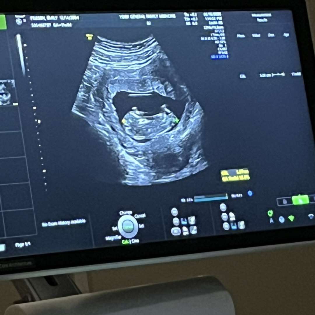 Photo shared by Christian for their Babylist baby registry.