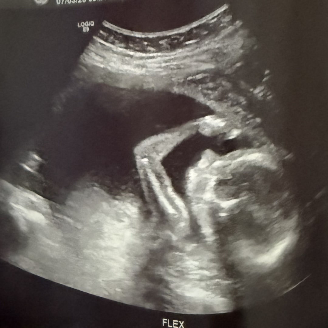Photo shared by Michelle for their Babylist baby registry.