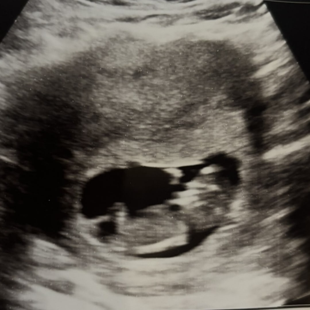 Photo shared by Michelle for their Babylist baby registry.