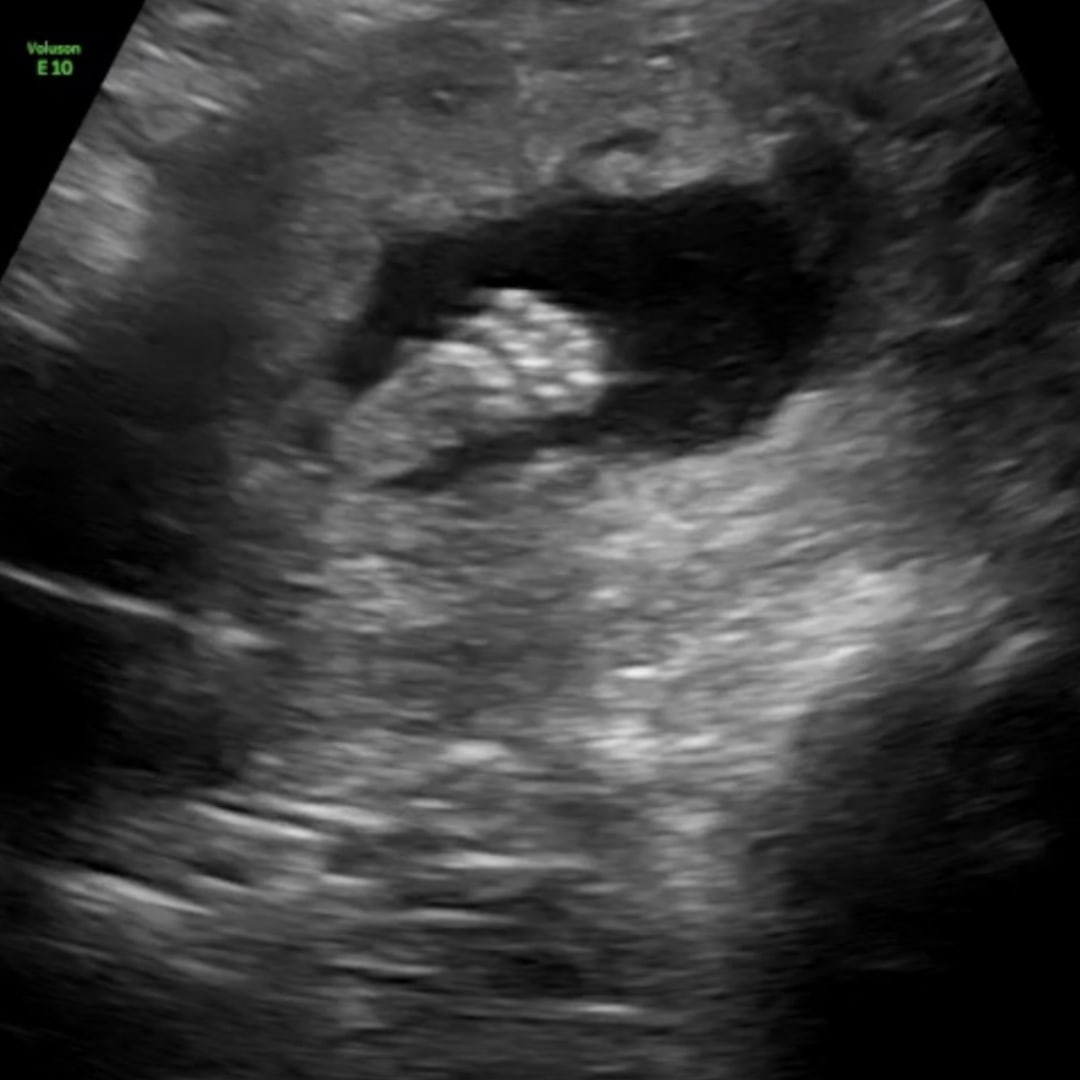 Photo shared by Lucero for their Babylist baby registry.