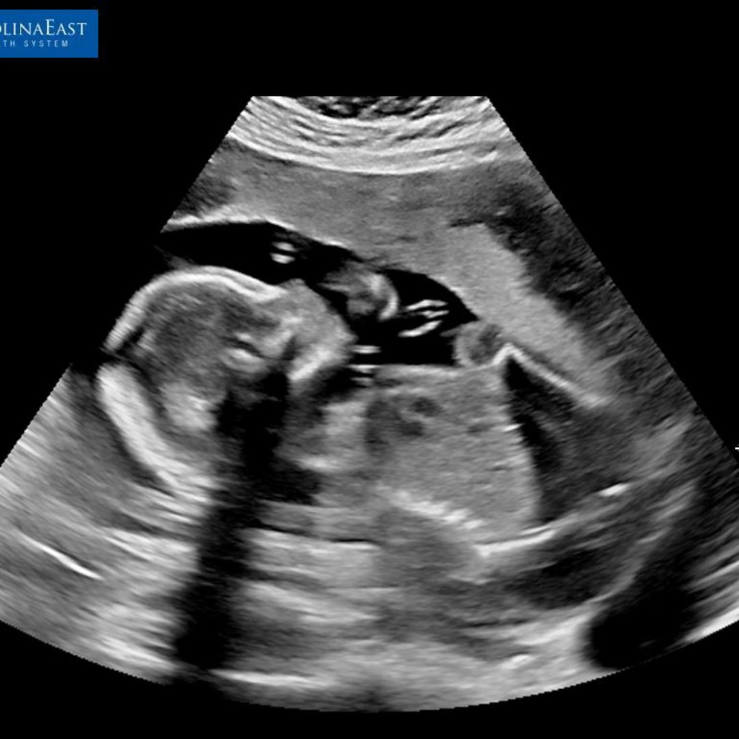 Photo shared by Ariel for their Babylist baby registry.