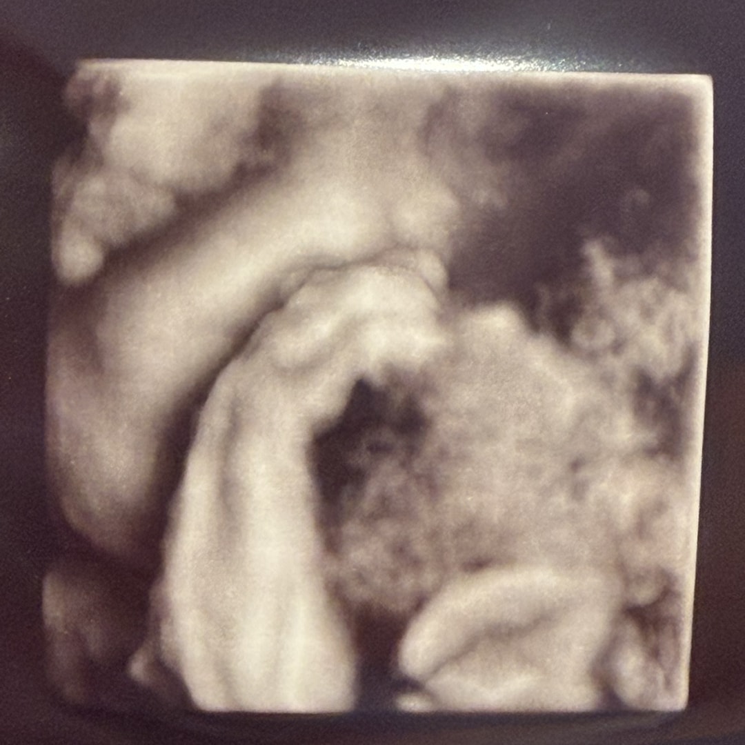 Photo shared by Hannah for their Babylist baby registry.
