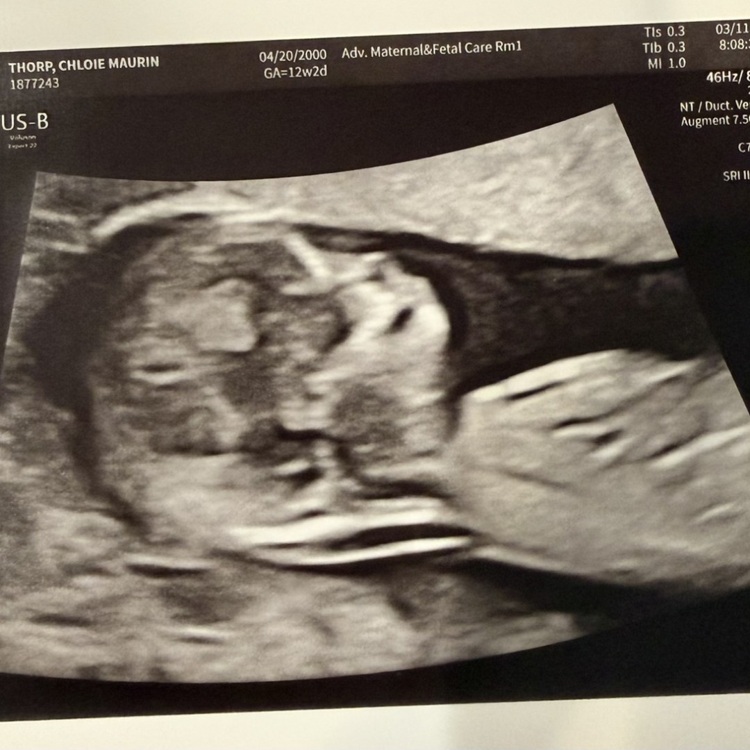 Photo shared by Chloie for their Babylist baby registry.
