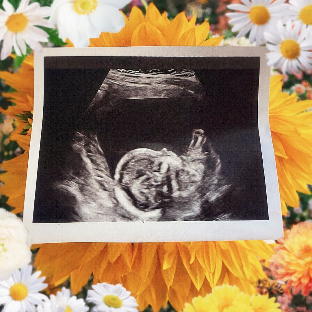 Photo shared by Bailey for their Babylist baby registry.