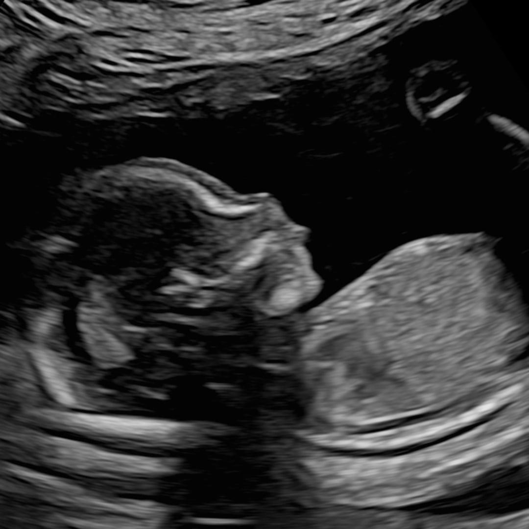 Photo shared by Arlette for their Babylist baby registry.