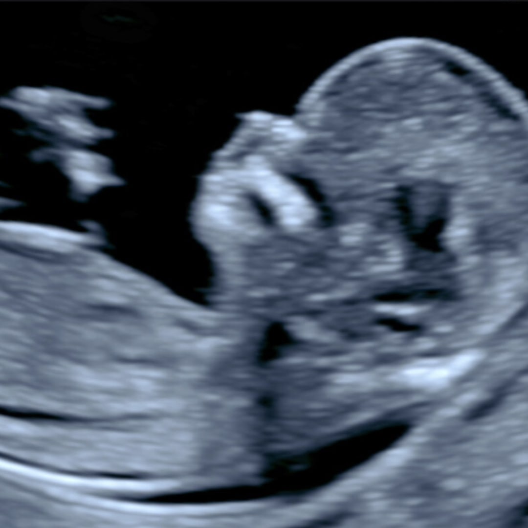 Photo shared by Karen for their Babylist baby registry.