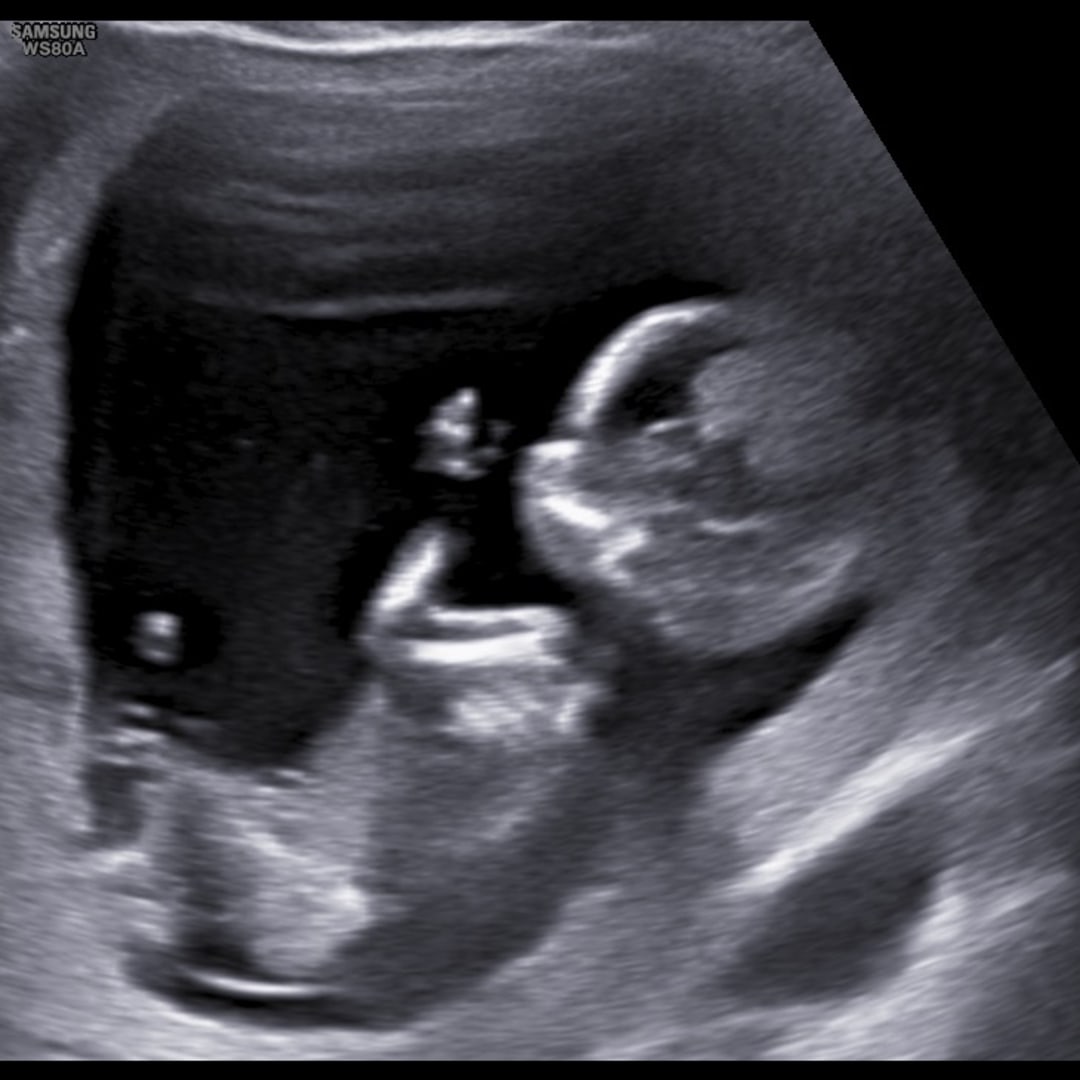 Photo shared by Kaylee for their Babylist baby registry.