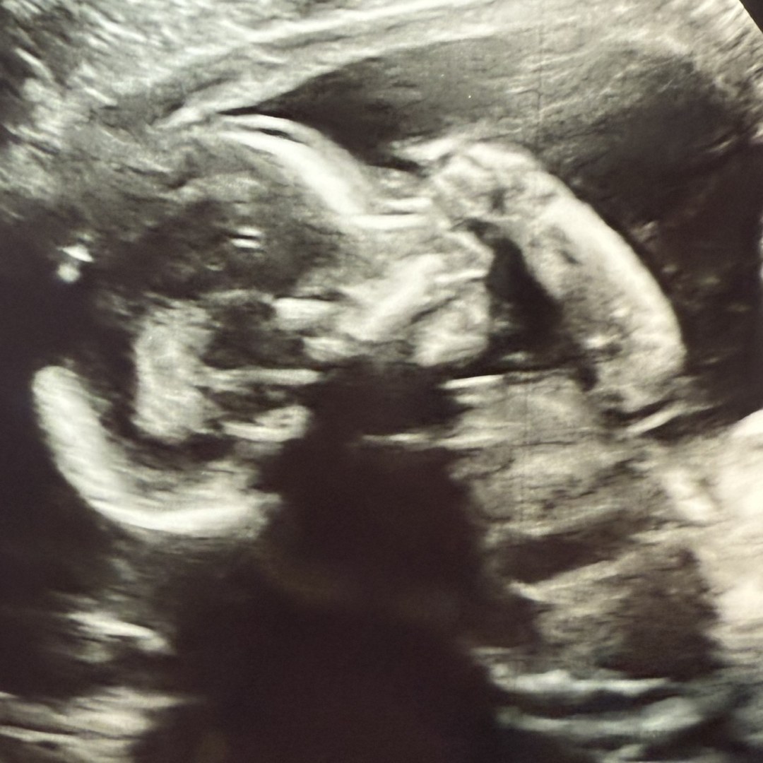 Photo shared by Chasney for their Babylist baby registry.