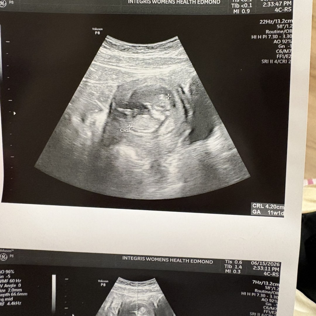Photo shared by Lawson for their Babylist baby registry.