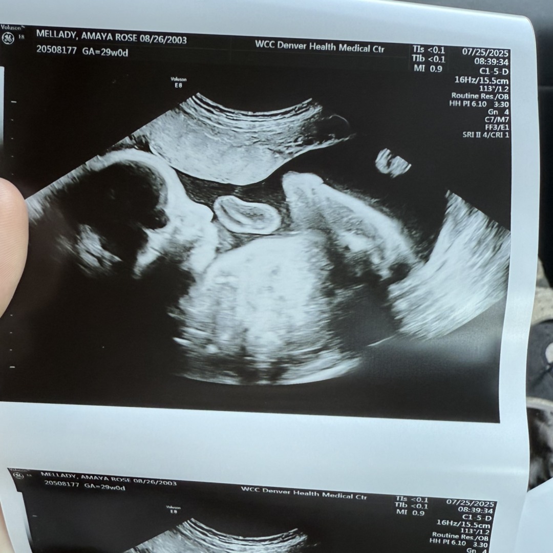 Photo shared by Amaya for their Babylist baby registry.