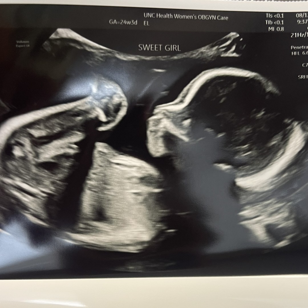 Photo shared by Miranda for their Babylist baby registry.