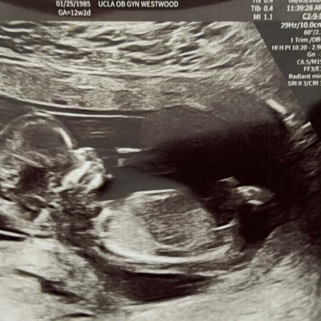 Photo shared by Jordan for their Babylist baby registry.