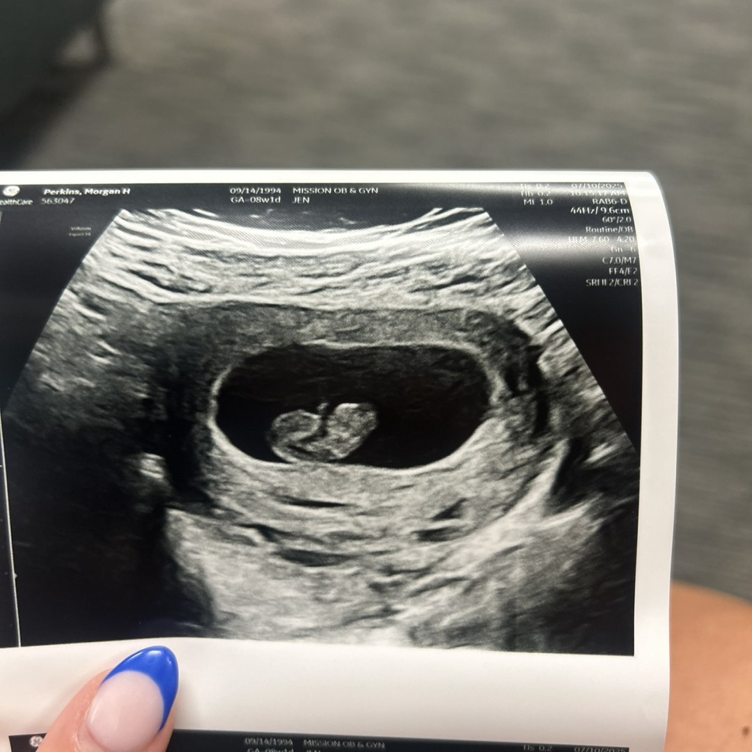 Photo shared by Morgan for their Babylist baby registry.
