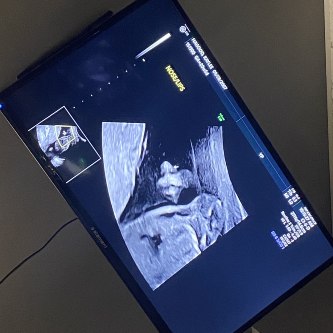 Photo shared by Kaylee for their Babylist baby registry.