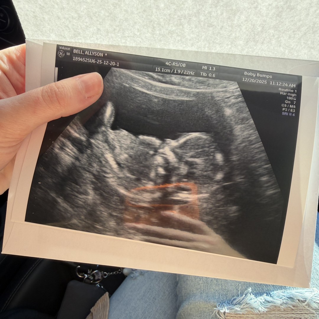 Photo shared by Ally for their Babylist baby registry.