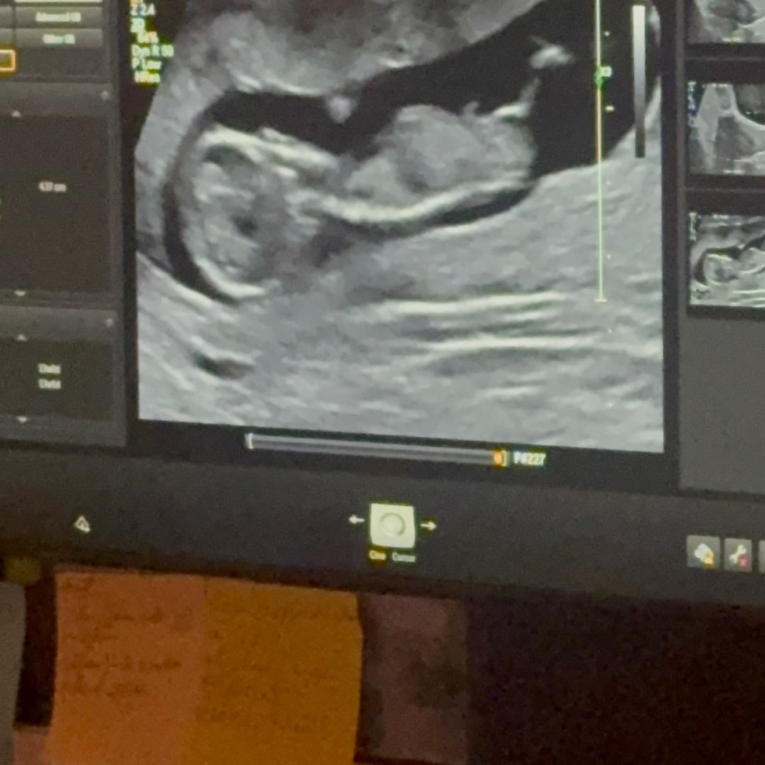 Photo shared by Jalena for their Babylist baby registry.