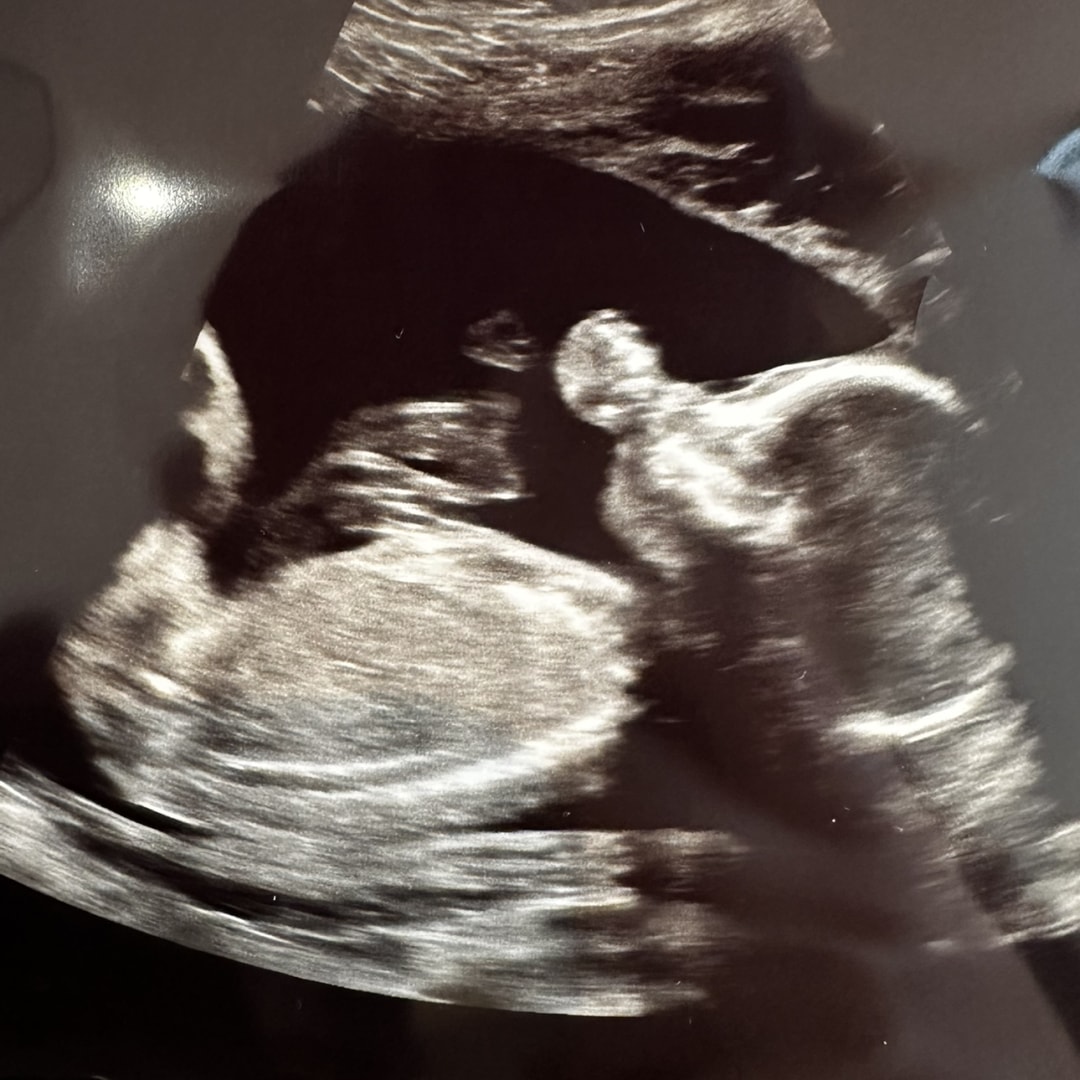Photo shared by Natalya for their Babylist baby registry.