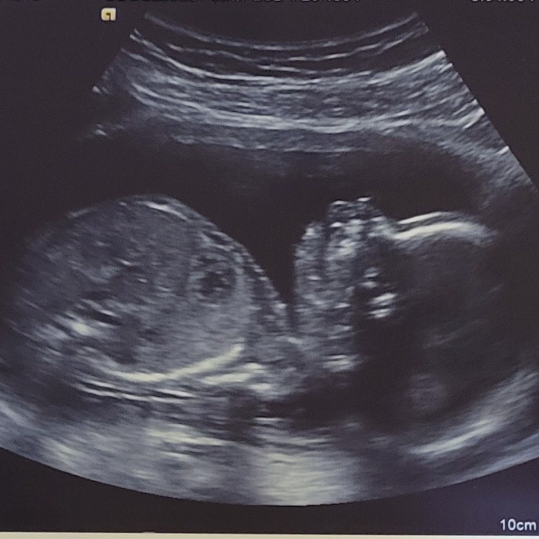 Photo shared by Anna for their Babylist baby registry.