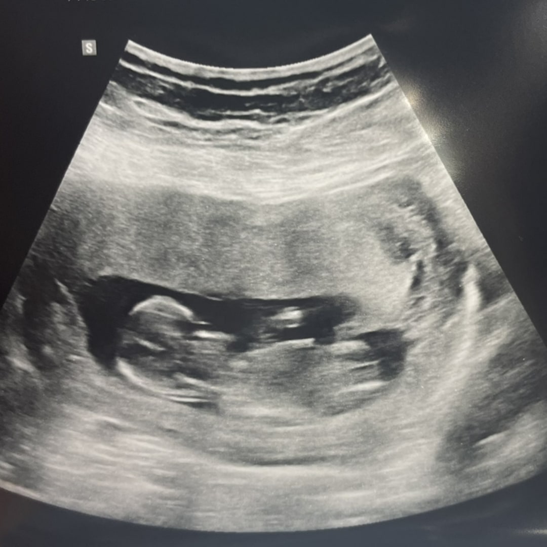 Photo shared by Sarah for their Babylist baby registry.