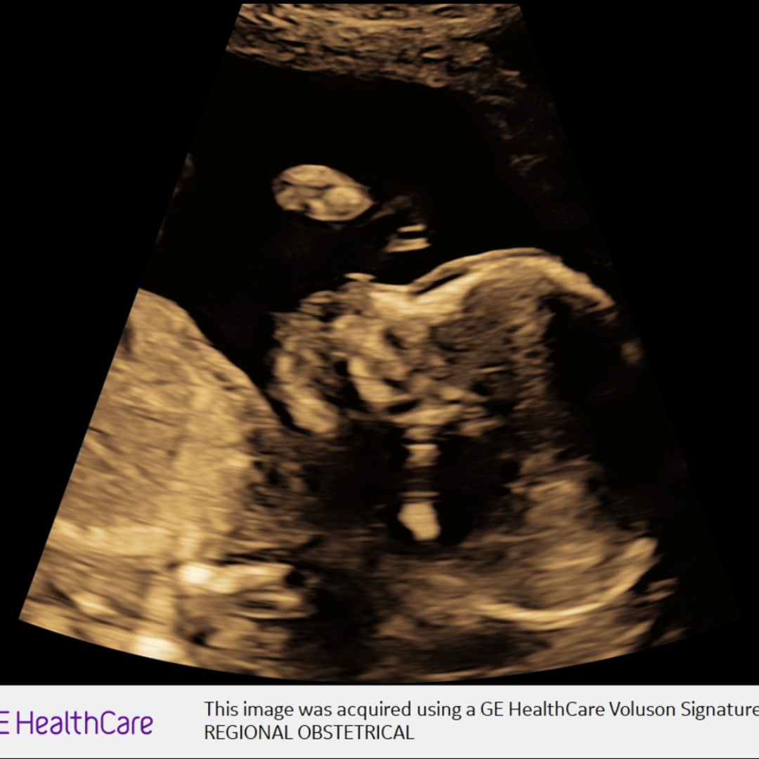 Photo shared by Heather for their Babylist baby registry.
