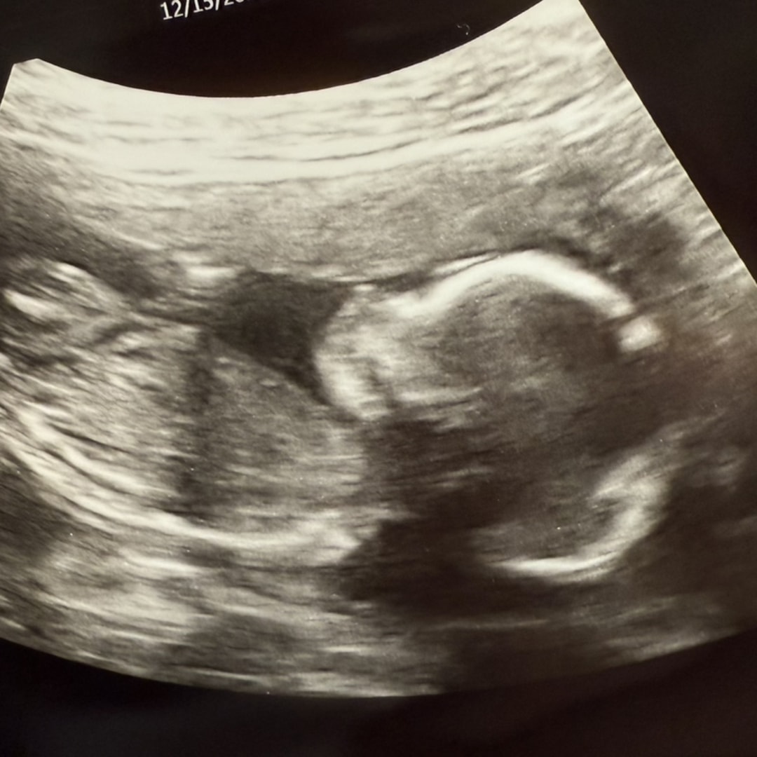 Photo shared by Molly for their Babylist baby registry.