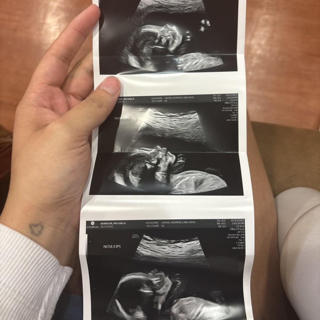 Photo shared by Michaela for their Babylist baby registry.