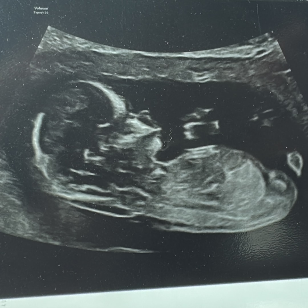 Photo shared by Voni for their Babylist baby registry.