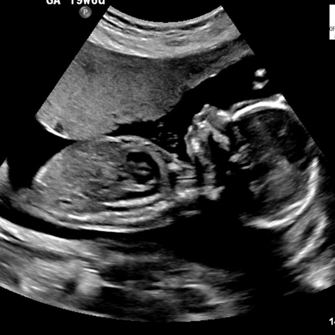 Photo shared by Sadez for their Babylist baby registry.