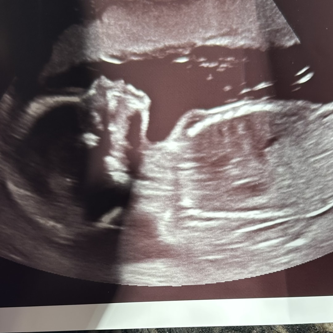 Photo shared by Kyleigh for their Babylist baby registry.