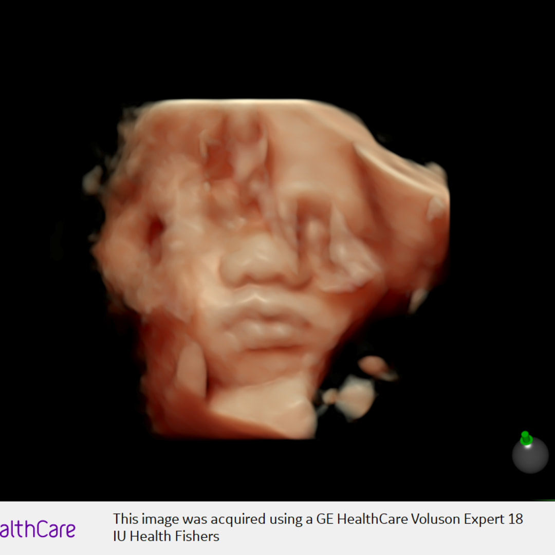 Photo shared by Jake & Stephanie for their Babylist baby registry.