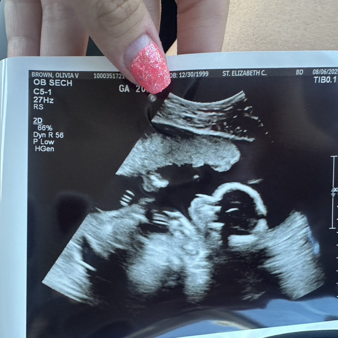 Photo shared by Olivia for their Babylist baby registry.