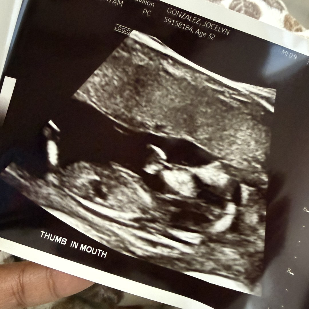 Photo shared by Jocelyn for their Babylist baby registry.