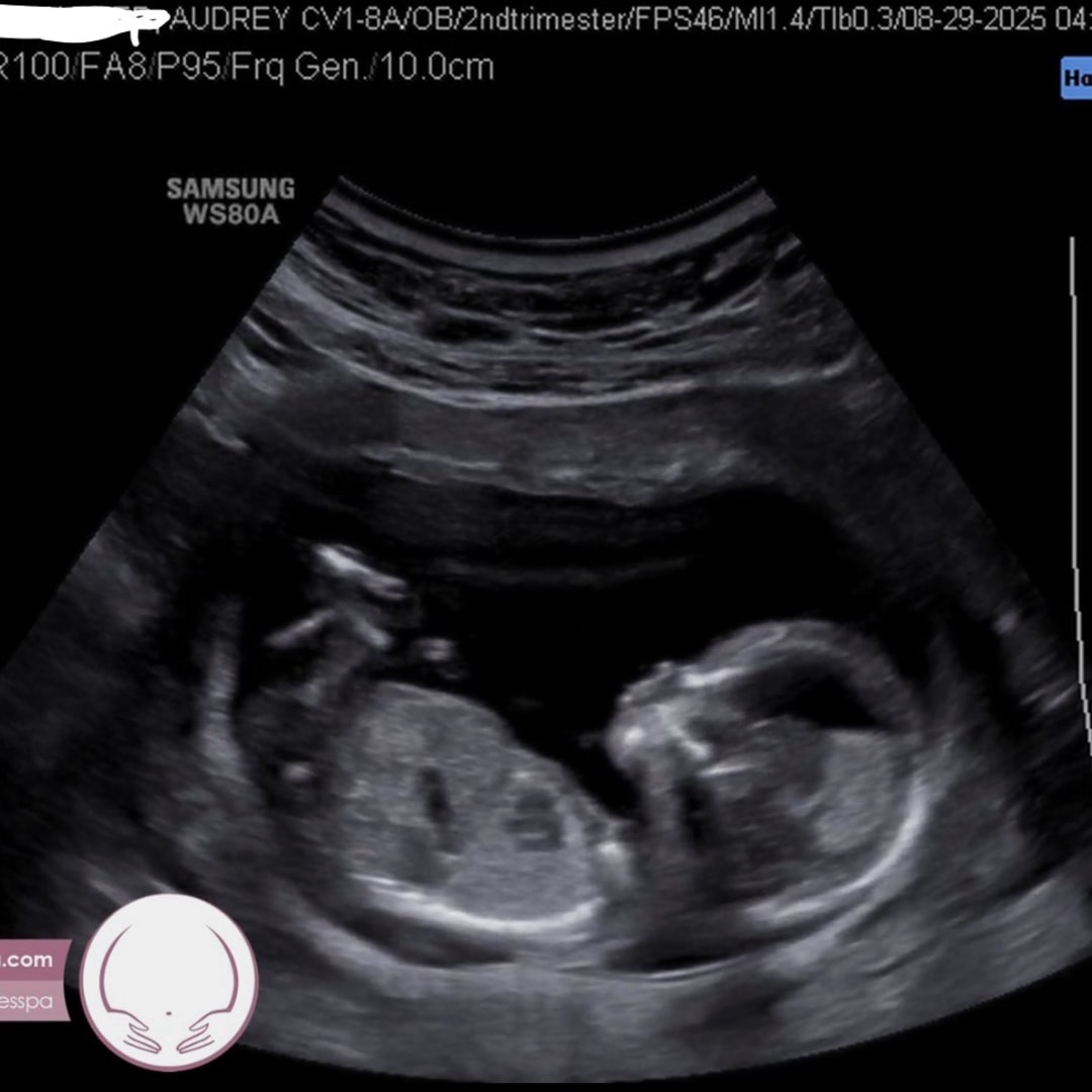 Photo shared by Audrey for their Babylist baby registry.