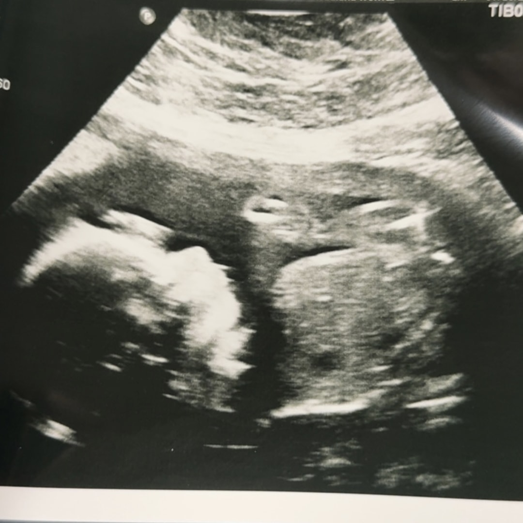 Photo shared by Haleigh for their Babylist baby registry.